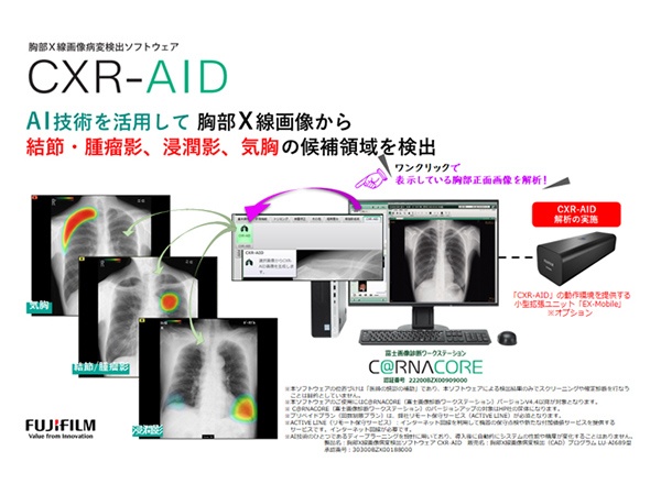 画像：内視鏡画像診断支援システム CXR-AID