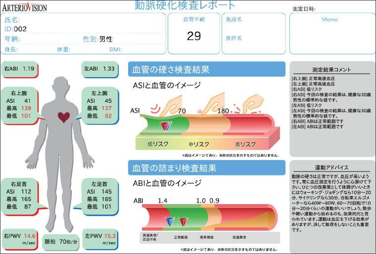 画像：血圧脈波検査装置 ArterioVision MS-3000